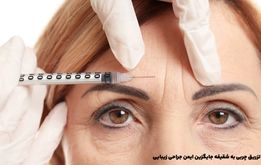 تزریق چربی به شقیقه جایگزین ایمن جراحی زیبایی